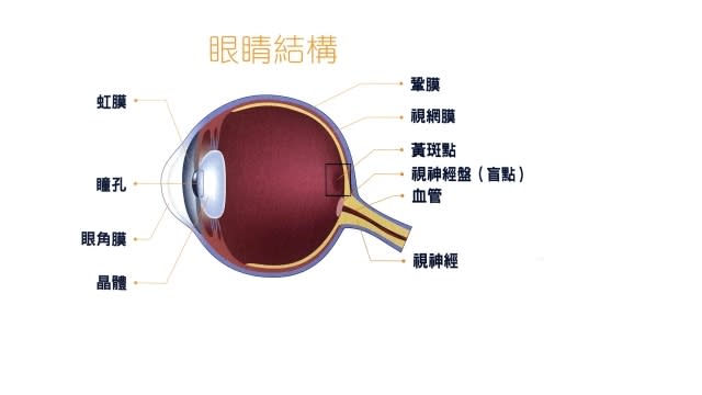 激光矯視並不能紓緩或預防深近視黃斑部脈絡膜新生血管病變（mCNV），因為矯視手術只針對角膜部份作矯正。