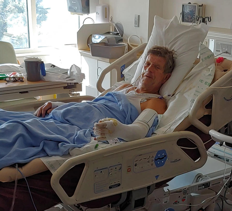 This Nov. 9, 2019, photo provided by Jessee Ernest shows his father, Paul Ernest, at the Firefighters Burn Institute Regional Burn Center intensive care unit at UC Davis in Sacramento, Calif. Paul Ernest, who had been hospitalized since the deadliest wildfire in California history incinerated his town in November 2018, has died, authorities said Thursday, Aug. 8, 2019. Jessee Ernest said his father died Monday, Aug. 5, of complications from burns on one-third of his body. (Jessee Ernest via AP)