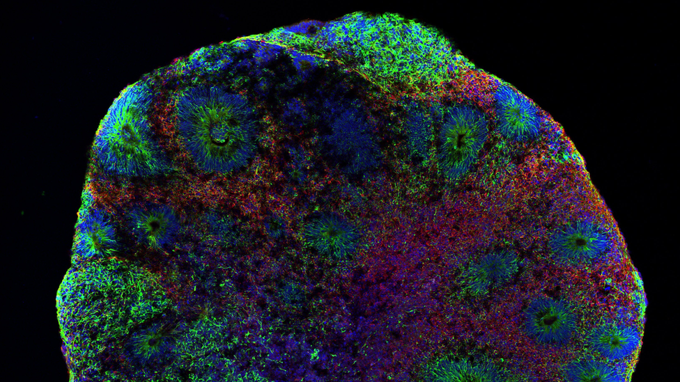 Foto tomada con un microscopio que muestra la estructura de un organoide