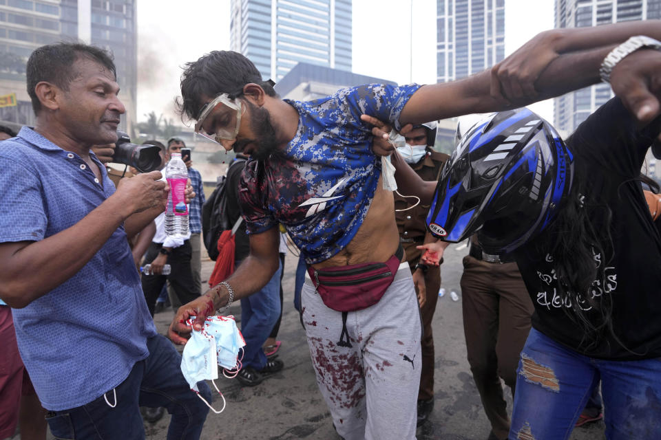 Anti-government protesters help a fellow protester who was beaten up by government supporters during a clash in Colombo, Sri Lanka, Monday, May 9, 2022. Government supporters on Monday attacked protesters who have been camped outside the offices of Sri Lanka's president and prime minster, as trade unions began a “Week of Protests” demanding the government change and its president to step down over the country’s worst economic crisis in memory. (AP Photo/Eranga Jayawardena)