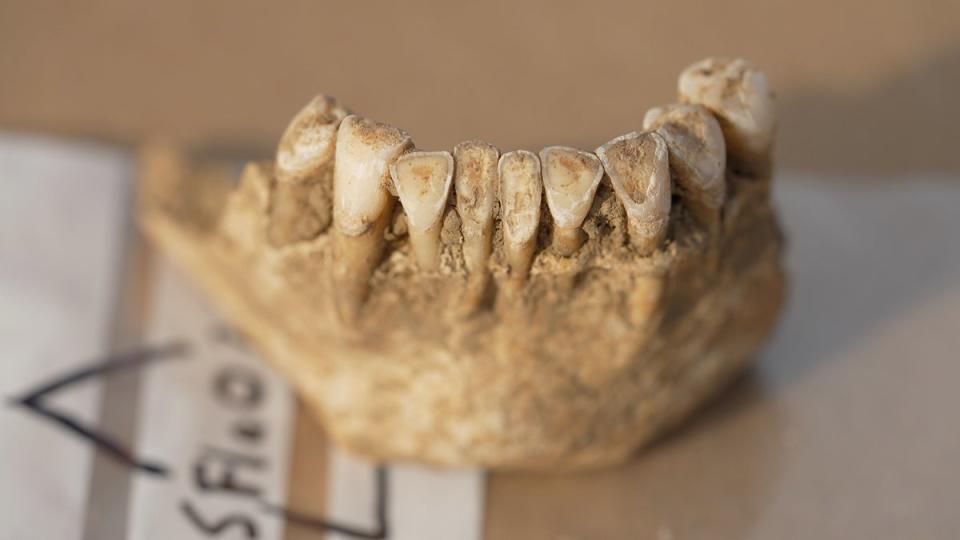 The front teeth from one of the skeletons are very worn (BBC News & Current Affairs via Getty)