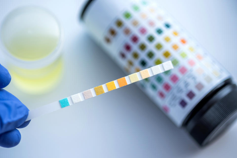 According to this study from The Substance Abuse and Mental Health Services Administration (SAMHSA), EMIT urine drug screening tests are the least expensive, most widely used, and simplest test to conduct, and they typically cost $1 to $5 per drug you're screening for. My novice googling says one of the most complete urine tests screens for 25 drugs, in which case an EMIT test should cost in the range of $25–$225.