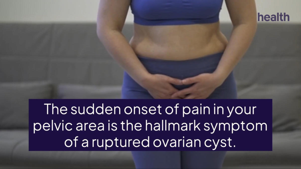 what-to-know-about-ruptured-ovarian-cysts