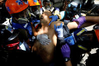 <p>An injured man receives help at a rally against Venezuelan President Nicolas Maduro’s government in Caracas, Venezuela, July 26, 2017. (Photo: Carlos Garcia Rawlins/Reuters) </p>