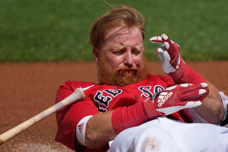 Boston Red Sox Justin Turner reacts after being hit in the face on a pitch by Detroit Tigers starting pitcher Matt Manning in the first inning of their spring training baseball game in Fort Myers, Fla., Monday, March 6, 2023.