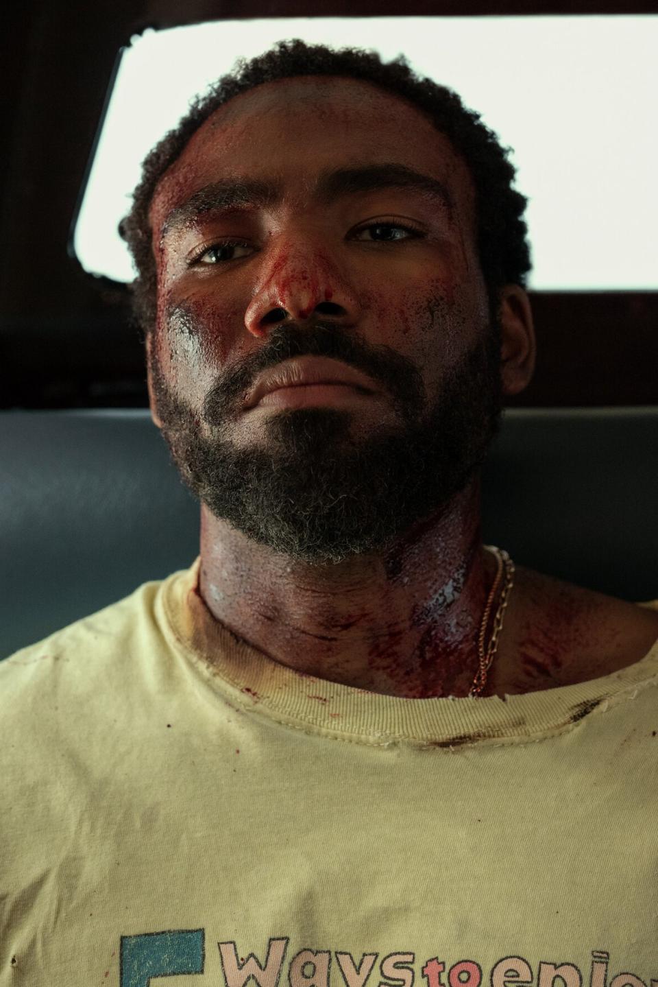 Donald Glover, injured and disheveled, sits in a vehicle seat, wearing a tattered shirt