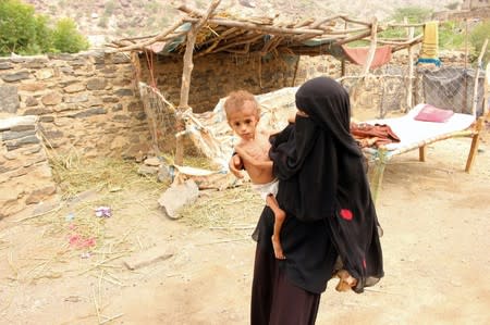 Grandmother of malnourished Muath Ali Muhammad carries him near their home in Aslam district of the northwestern province of Hajja