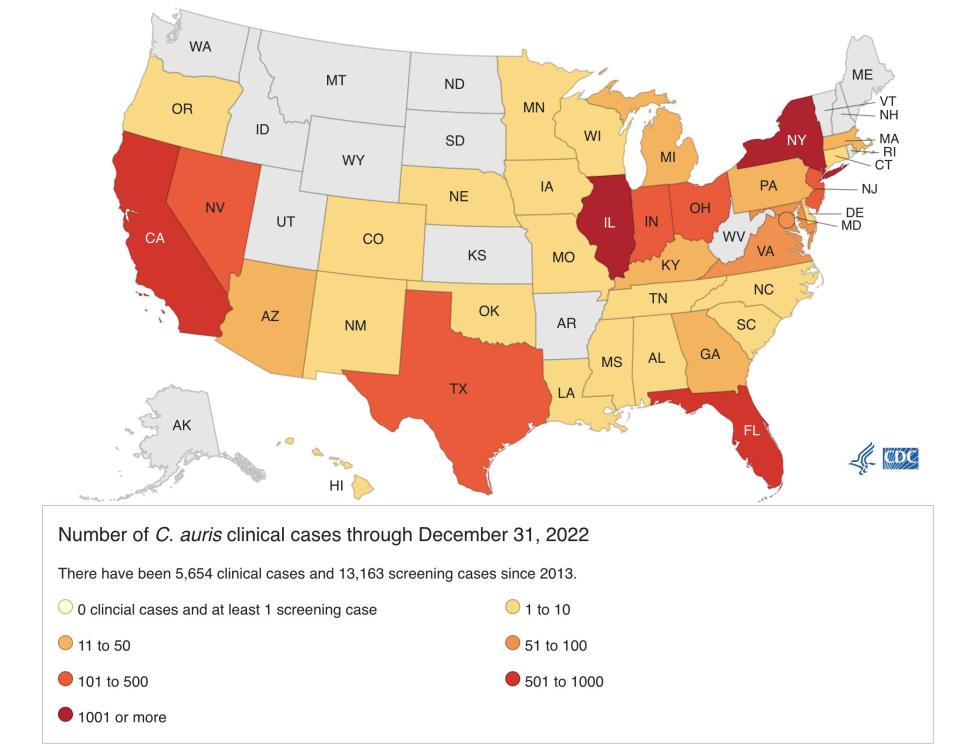 CDC map of Candida auris infections in the US, 2013-2022