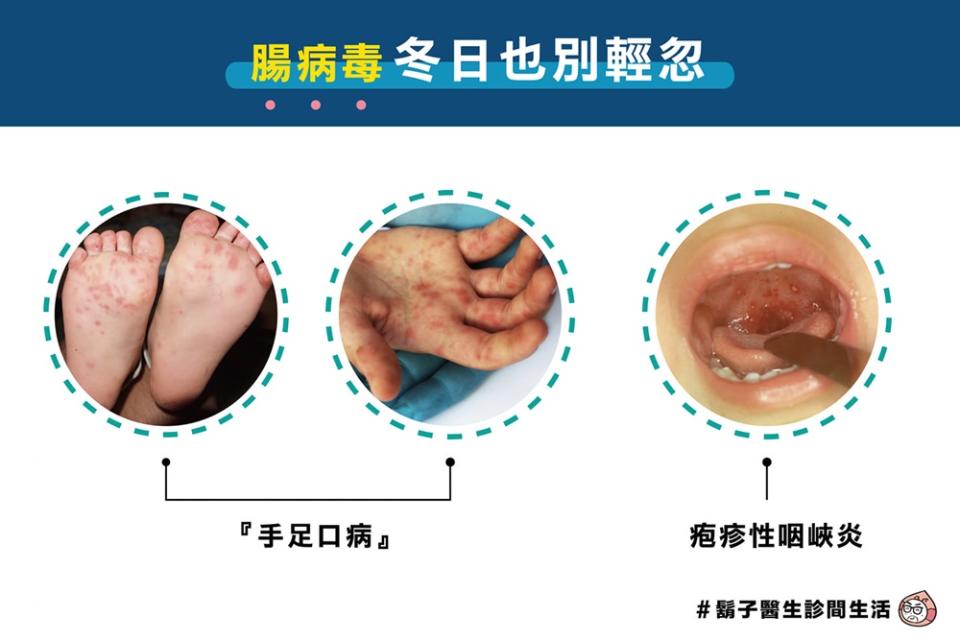 冬日也別輕忽腸病毒。（圖片來源／鬍子醫生診間生活臉書）
