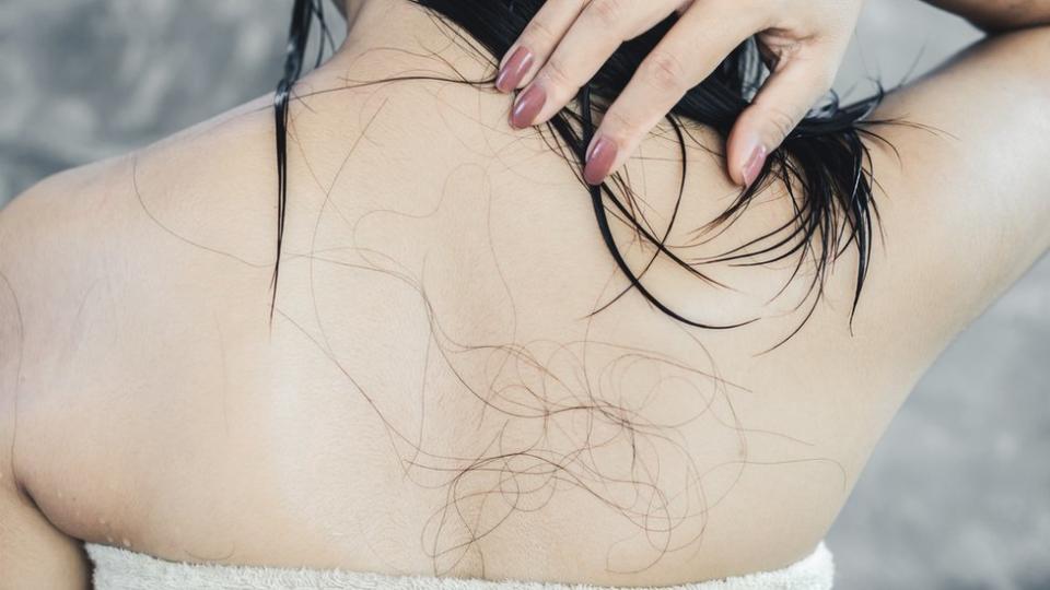 Mujer que sufre pérdida de cabello