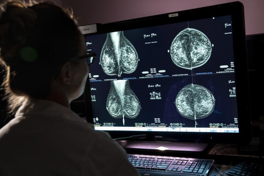 Westwood, CA - May 11: Dr. Hannah Milch, assistant clinical professor, Department of Radiology at the David Geffen School of Medicine at UCLA in Westwood, CA, is photographed reviewing a mammogram Tuesday, May 11, 2021. (Jay L. Clendenin / Los Angeles Times)