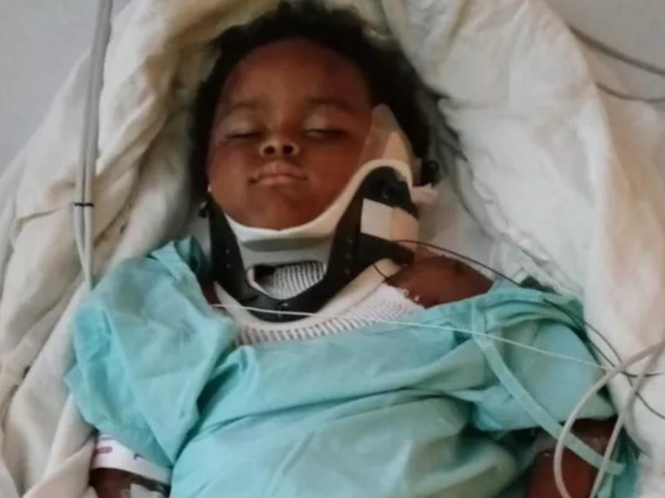 An image shared on GoFundMe by the family of Carson, 4, who was attacked by a pit bull (Esther Zero / Cortney Neal / GoFundMe)