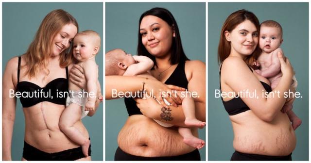 This Campaign Celebrates Postpartum Bodies To End Unrealistic Expectations  For New Moms