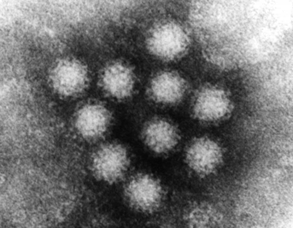 Norovirus is a member of a genus of viruses that cause around 50 percent of all gastroenteritis around the world.