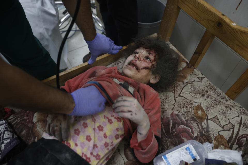 A Palestinian child wounded in the Israeli bombardment of the Gaza Strip is treated in Khan Younis on Friday, Dec. 8, 2023. (AP Photo/Mohammed Dahman)