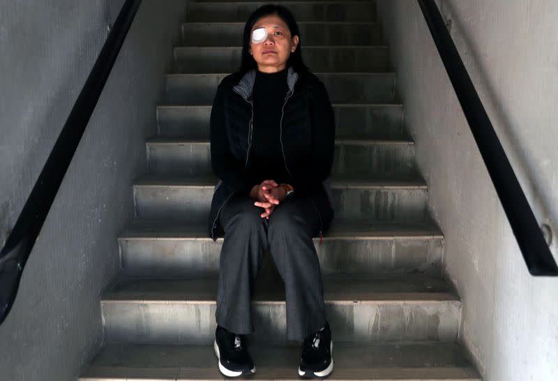 Indonesian journalist Veby Mega Indah, whose right eye was severely injured by Hong Kong police during a protest, poses for a portrait in Hong Kong, China