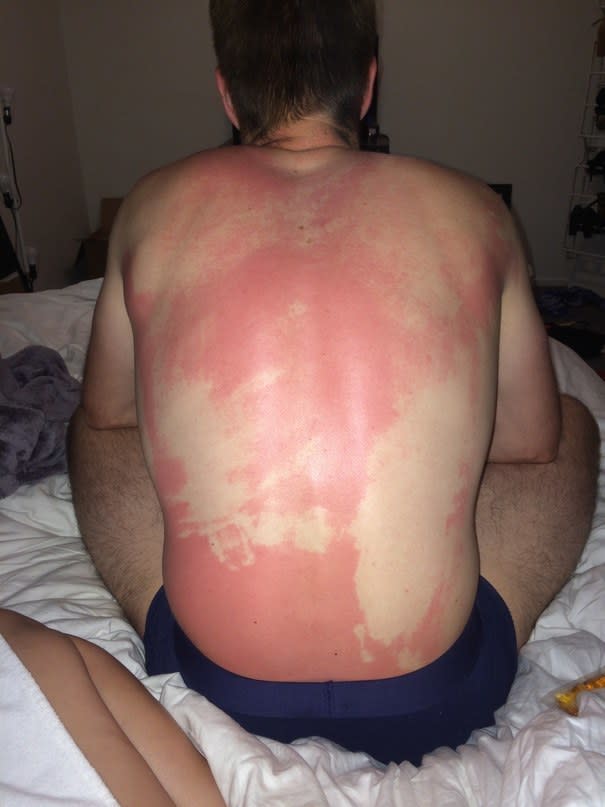 This guy tried to put suncream on while paddle boarding