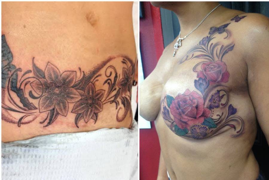 These Women Are Taking Ownership of Their Scars With Beautiful Tattoos