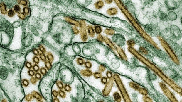 A colourized transmission electron micrograph shows Avian influenza A H5N1 viruses (seen in gold) grown in MDCK cells (seen in green). The U.S. is dealing with an avian flu outbreak in dairy cattle, with the virus showing up in close to 70 herds across nine states so far. In Canada, no H5N1 viral fragments have been found in milk.  