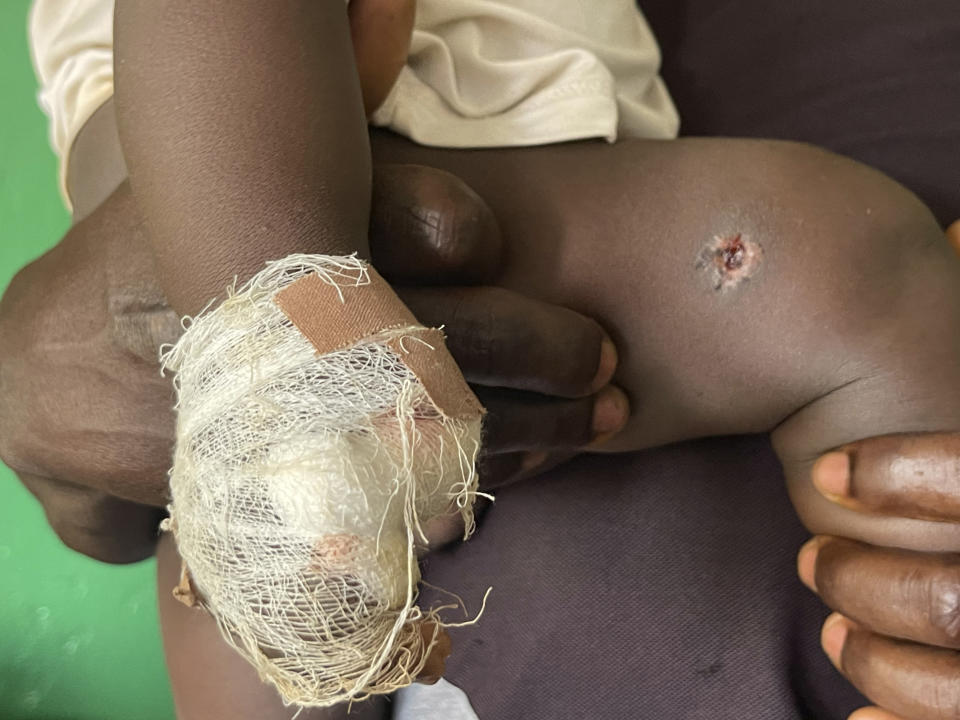 Joshua Jonathan carries his 9-month-old son Christian who is recovering inside a hospital in Kunji, Southern Kaduna, Nigeria, Thursday April 27, 2023. Christian was shot in the leg by unidentified gunmen who also cut his finger after killing his mother. (AP Photo/Chinedu Asadu)