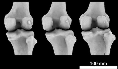 The fabella is found in the tissues behind the kneecap  - Credit: Michael Berthaume/Imperial College London