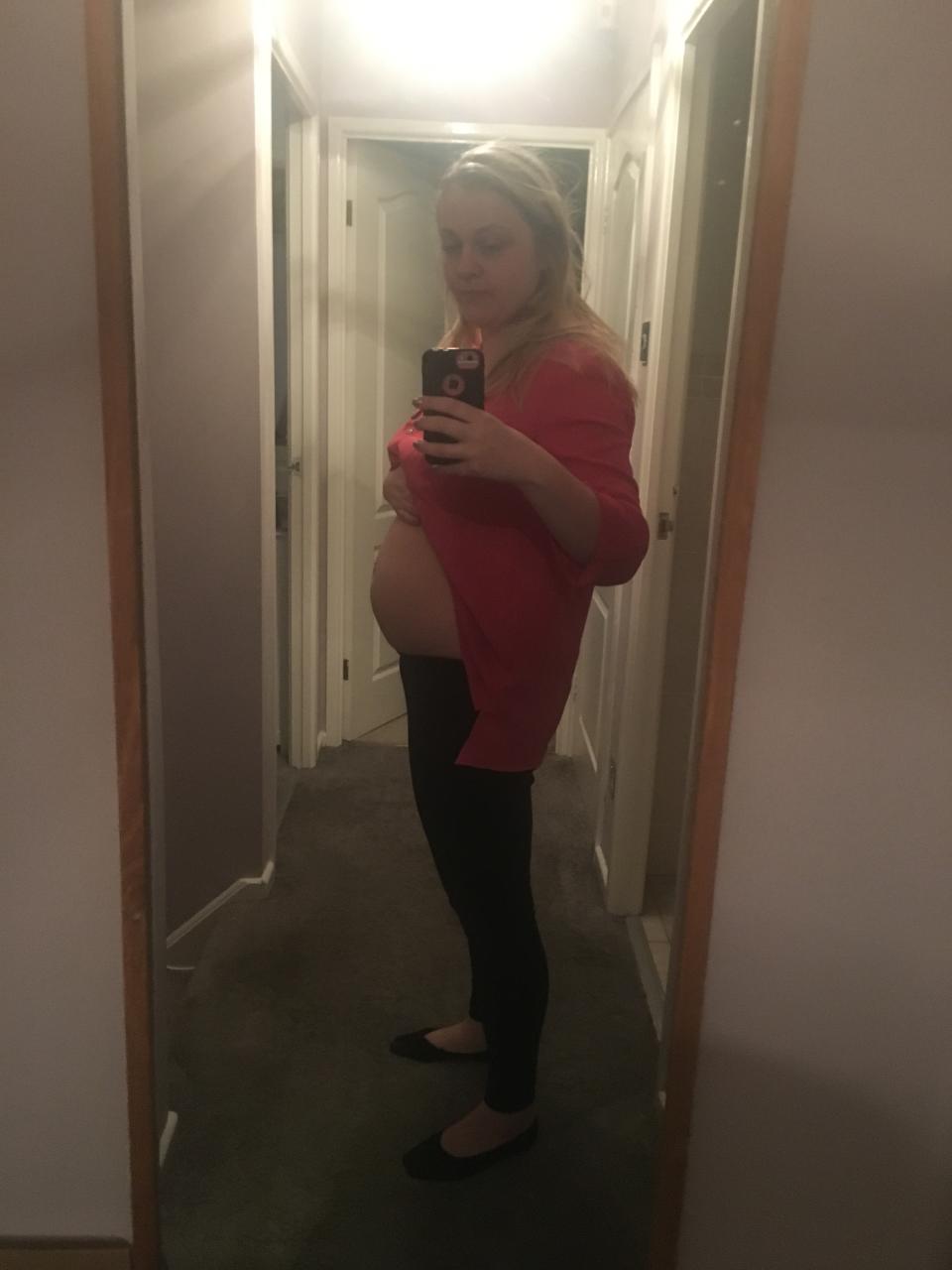 A personal image that shows the bloating she endured