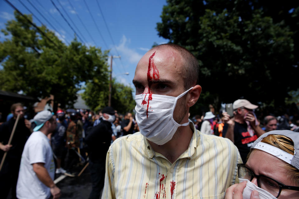 A man is seen with an injury during a clash between white nationalists&nbsp;and counter-protesters.