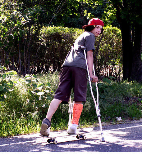teen cast broken leg skateboard