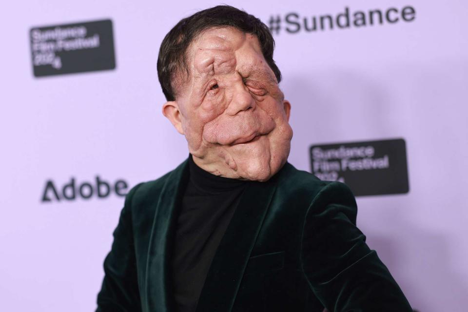 <p>Matt Winkelmeyer/Getty</p> Adam Pearson