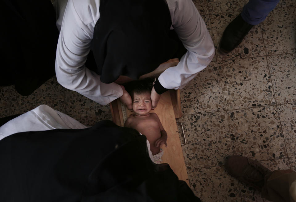 <p>Galila, a 9-month old Yemeni child who suffers from malnutrition, is weighed at the Stabilization Nutritional Therapeutic center in al-Khoukha, a town on Yemenâs Red Sea coast, in this Feb. 12, 2018 photo. The baby girl, who started wasting away after catching malaria, weighed 4.5 kilograms (9.9 pounds), compared to the average of 6 to 8 kilograms (13-17 pounds) for a girl her age. (Photo: Nariman El-Mofty/AP) </p>