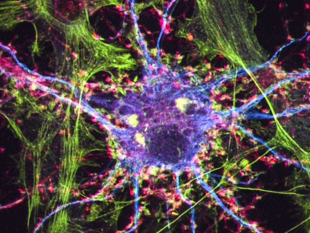 Image of a cortical neuron