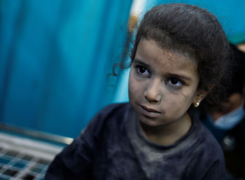 Una niña palestina herida en los ataques israelíes, en medio del conflicto entre Israel y el grupo palestino Hamás, espera recibir tratamiento en el hospital Nasser, en Jan Yunis, en el sur de la Franja de Gaza