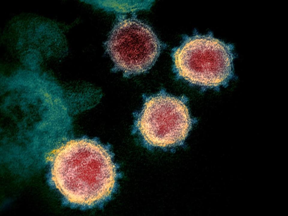 Virus particles that causes COVID-19, isolated from a patient, are shown emerging from the surface of cells cultured in a lab. The N.W.T. reported 34 new cases of COVID-19 Wednesday. The territory's case count now stands at 254, an increase of 16 since yesterday. (NIAID-RML/Reuters - image credit)