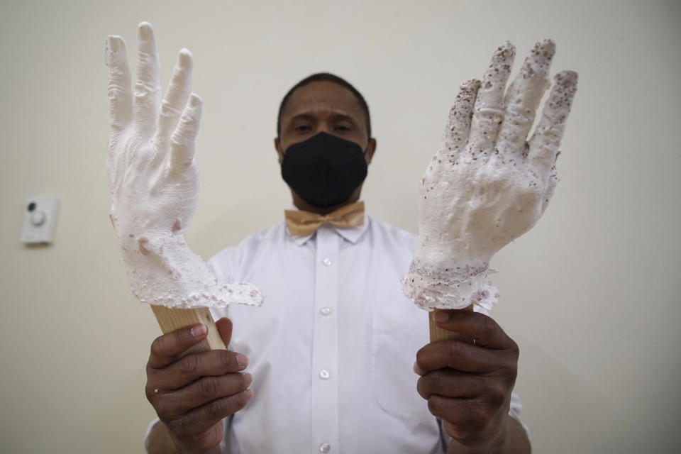 DeAndre Muhammad holds up plastic casts of his hands in a studio at the Gibbes Museum of Art in Charleston, S.C., on Thursday, Feb. 16, 2023. Muhammad is one of 36 people whose hands will be cast in bronze for a memorial to the likely enslaved people discovered in an unmarked burial ground. (AP Photo/Allen G. Breed)