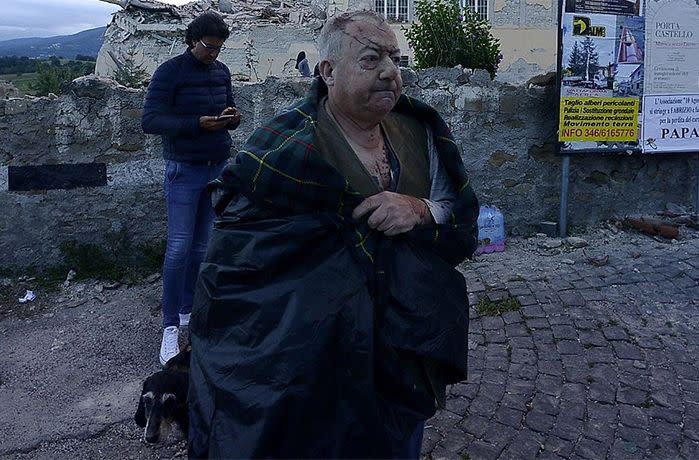 A heavily injured man gazes at his destroyed hometown of Amatrice following a devastating quake in August. Image: AFP/Getty