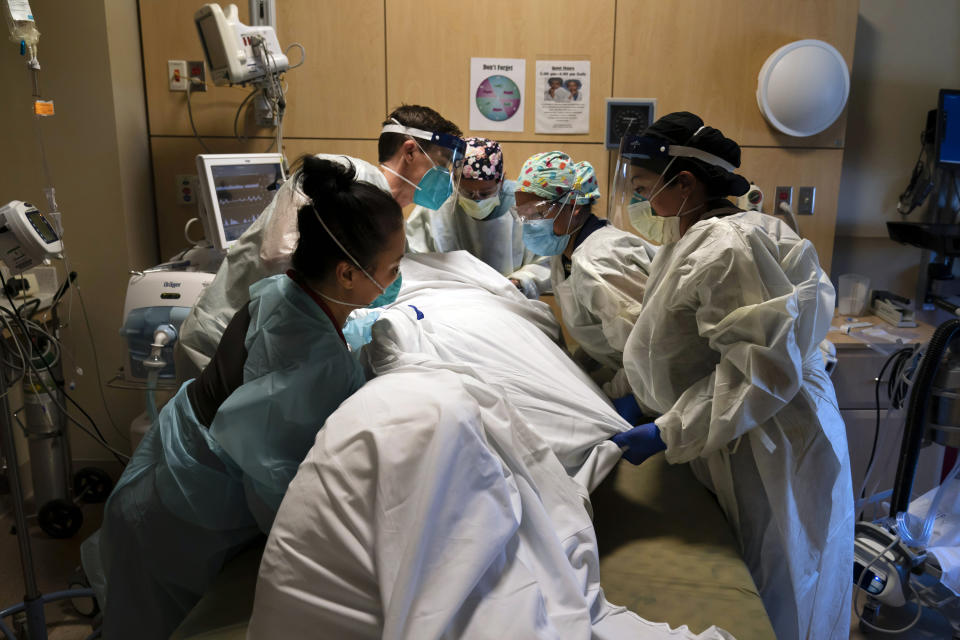 FILE - In this Nov. 19, 2020, file photo, medical personnel prone a COVID-19 patient at Providence Holy Cross Medical Center in the Mission Hills section of Los Angeles. Hospitals across California have all but run out of intensive care beds for COVID-19 patients, ambulances are backing up outside emergency rooms, and tents for treating the sick are going up as the nation’s most populous state emerges as the latest epicenter of the U.S. outbreak. (AP Photo/Jae C. Hong, File)