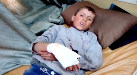 A boy lies on a bed with an injured hand after what is said to be a missile attack on a hospital in Azaz, Aleppo, Syria, February 15, 2016 in this still image taken from a video on a social media website. REUTERS/Social Media Website via Reuters TV