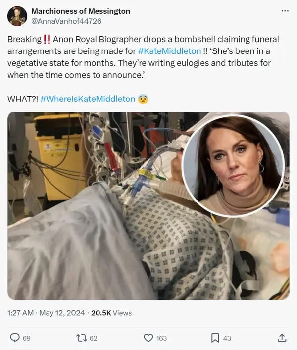Is Kate Middleton in a vegetative state?