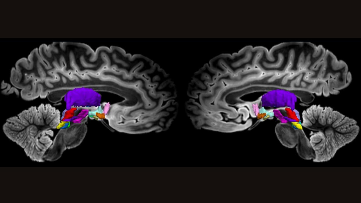  Two side-by-side MRI scans of the two halves of a human brain shows structures deep in the middle of the brain highlighted in different colors. 