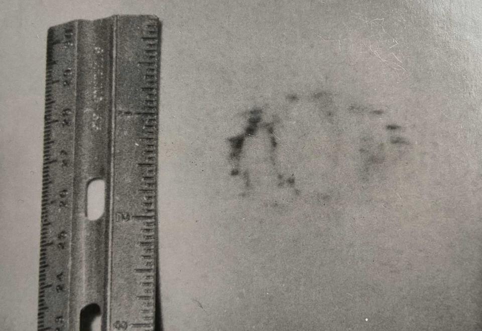 The bite mark was a crucial piece of evidence in the case against Ted Bundy. / Credit: Larry Simpson