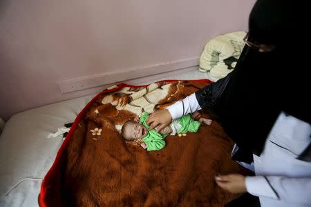 A nurse checks Ali Mohammed al-Tawaari, a six-month-old malnourished boy, at a hospital in Sanaa, Yemen July 28, 2015. REUTERS/Khaled Abdullah