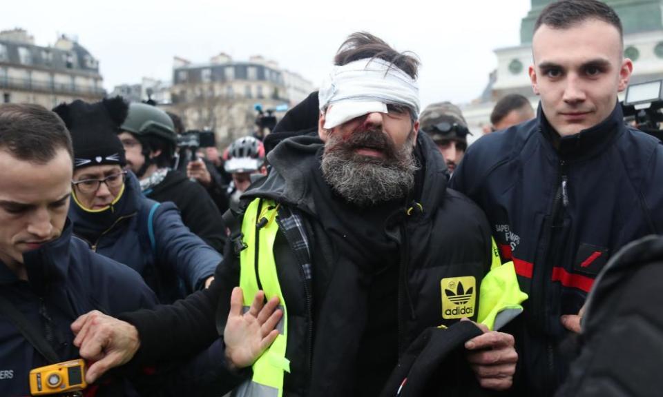 A gilets jaunes leader is led away after an eye injury