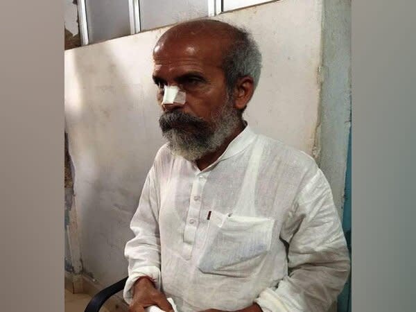 Union Minister Pratap Chandra Sarangi during his treatment after the road accident. (Photo/ ANI)