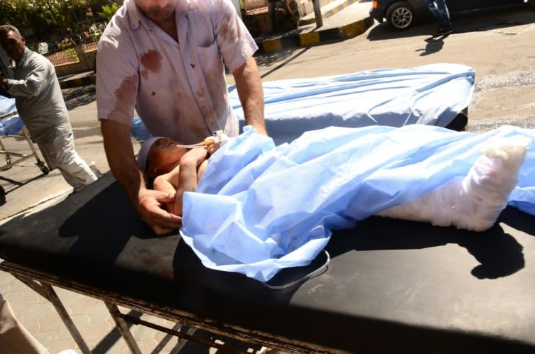 A wounded Syrian child is rushed into a hospital after she was hit by mortar shells that targeted Aleppo's government-controlled Aziziyah and Suleimaniyah neighbourhoods on September 28, 2016