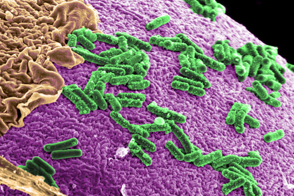 such neurological diseases as Alzheimer's and Huntington's diseases. In an effort to understand microbiome behavior, researchers at Pacific Northwest National Laboratory are growing gut bacteria on human intestinal cells.