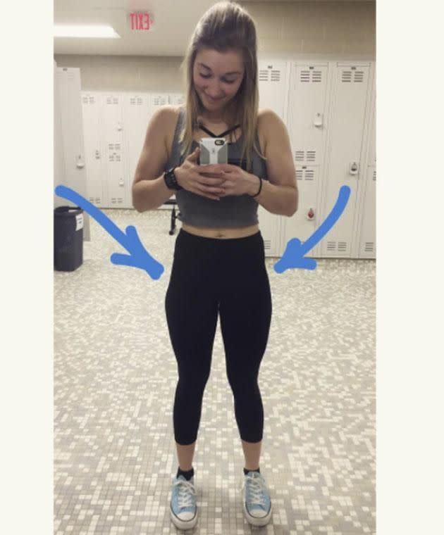Learn to love your hip dips. Photo: Instagram