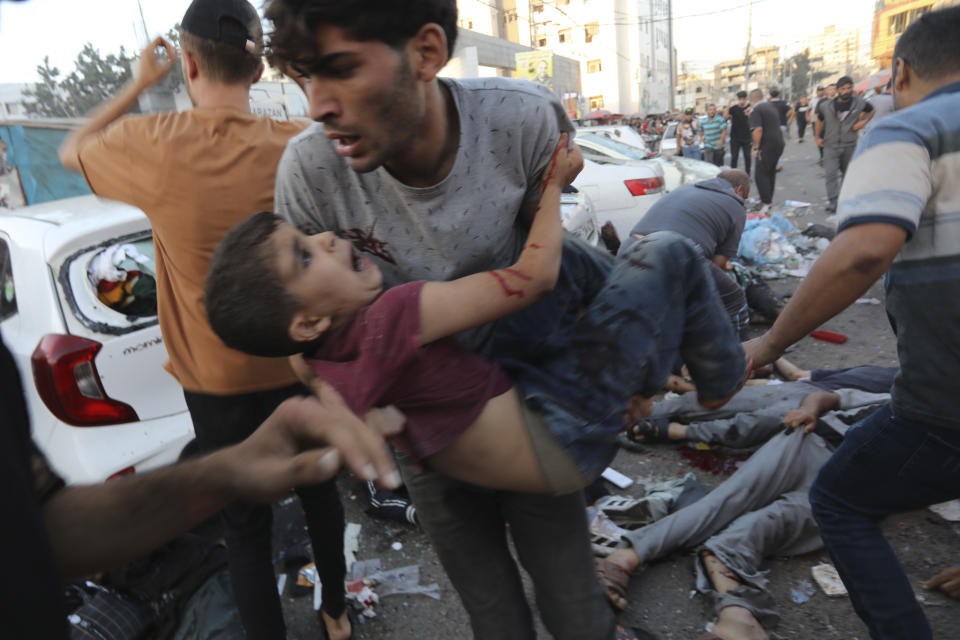 Un niño palestino herido es llevado en brazos por un hombre tras un bombardeo israelí frente a la entrada del Hospital Al Shifa, el viernes 3 de noviembre de 2023, en la Ciudad de Gaza. (AP Foto/Abed Khaled)