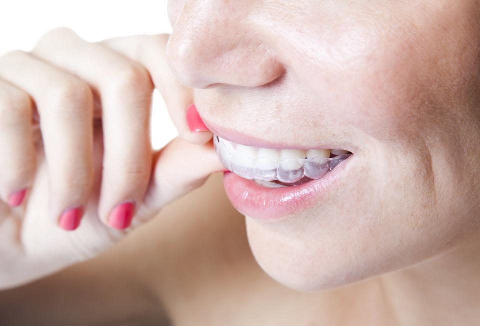 Tray-based teeth whiteners: What to know