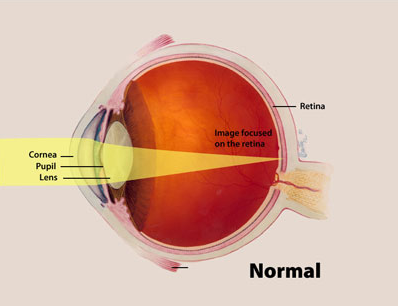 Looking at the retina at the back of the eye could provide information about whether a person has ADHD or autism.