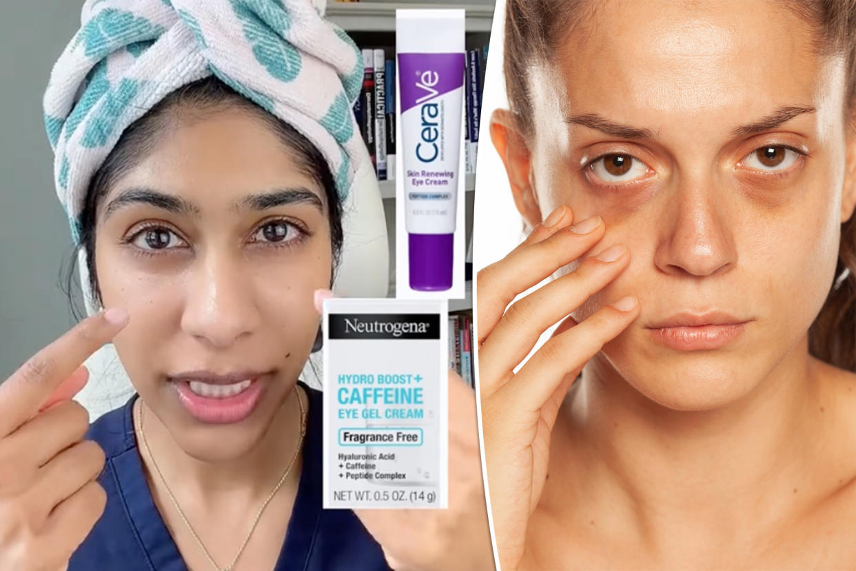 Dermatologist Dr. Neera Nathan is sharing three ways to reduce puffiness under eyes caused by fluid accumulation — an eye cream that contains topical caffeine, Arnica gel, and an antihistamine.